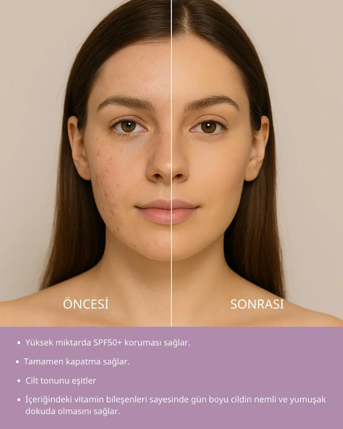 BB Krem spf 50 Yüksek Korumalı Akne Leke İzleri Kararma Beyazlatıcı Dark - 1 BB Krem spf 50 Yüksek K